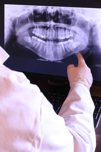 Best Emergency Treatment for Dental Infections or Abscesses in Corcoran, CA