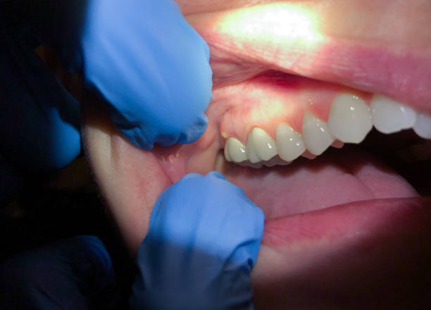Best After-Hours Dental Trauma Care in Corcoran, CA