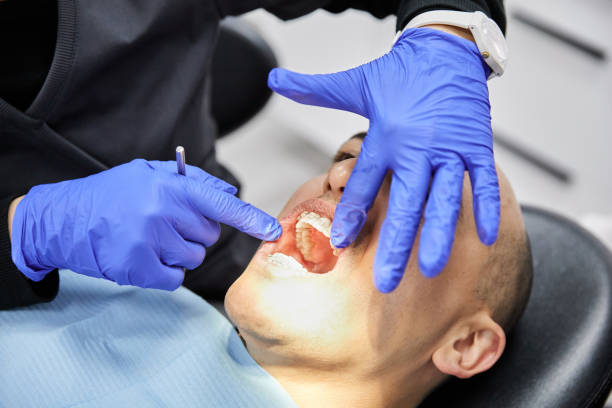 Best Emergency Dental Care for Broken or Chipped Teeth in Corcoran, CA